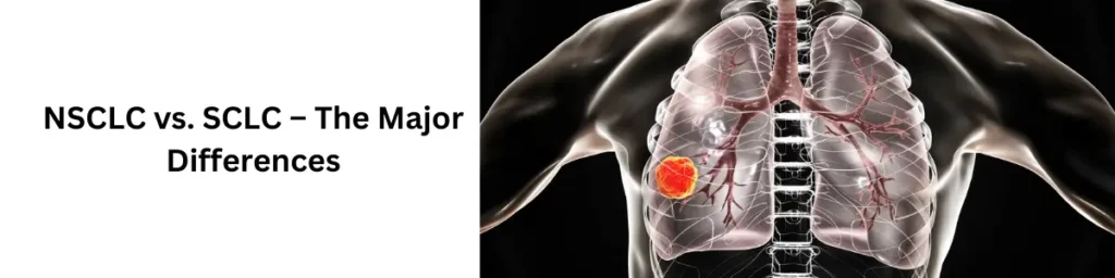 The Truth About NSCLC and SCLC Lung Cancer NSCLC vs. SCLC – The Major Differences