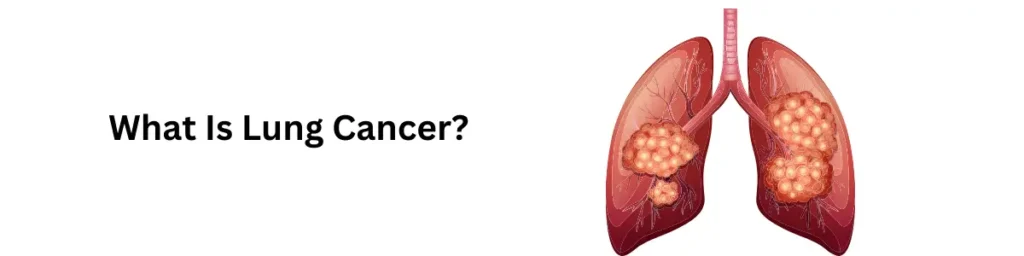 The Truth About NSCLC and SCLC Lung Cancer What Is Lung Cancer?